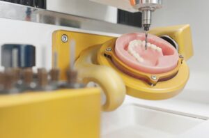 Advantages of digital denture technology for your laboratory